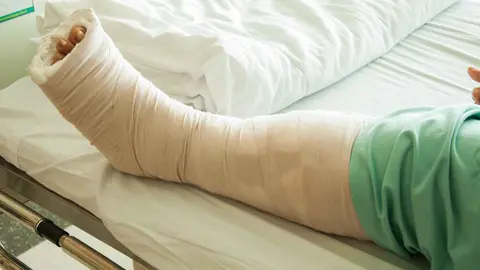 Va a robar tabaco a un estanco de C&oacute;rdoba y se lleva cajetillas y una pierna rota