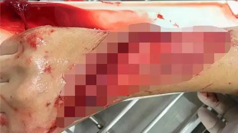 Apu&ntilde;alan a un joven en M&aacute;laga y lo dejan tirado desangr&aacute;ndose