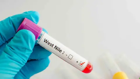 El virus del Nilo sigue muy presente en Andaluc&iacute;a