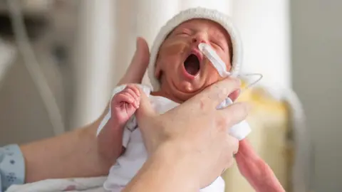 La voz de las madres reduce el dolor y el estr&eacute;s de los beb&eacute;s prematuros