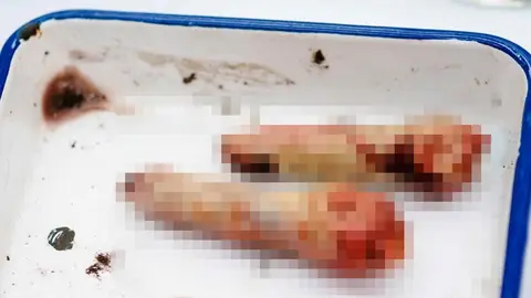 Una mujer arranca dos dedos a su compa&ntilde;era de piso y se los come   