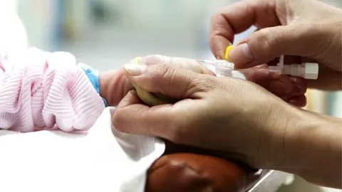 Cae un porche sobre un beb&eacute; de 14 meses en Mallorca