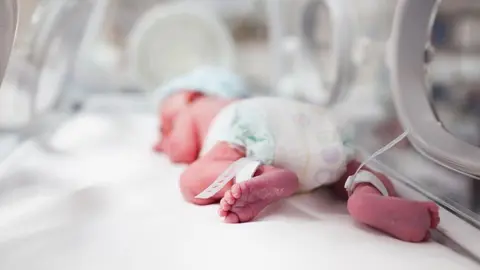 Un beb&eacute; prematuro sobrevive gracias a las venas artificiales