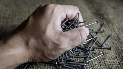 Un hombre se vuelve adicto a ingerir clavos y tornillos: Encuentran 1 kilo en su est&oacute;mago
