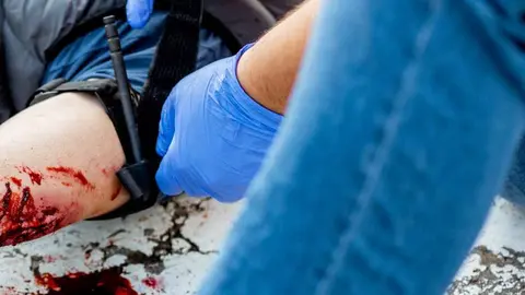 Agentes de la Polic&iacute;a Nacional salvan la vida a un joven de Dos Hermanas con un torniquete