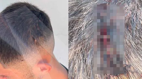 Hospitalizado un menor tras ser reducido por la Polic&iacute;a Nacional en un botell&oacute;n en Jerez