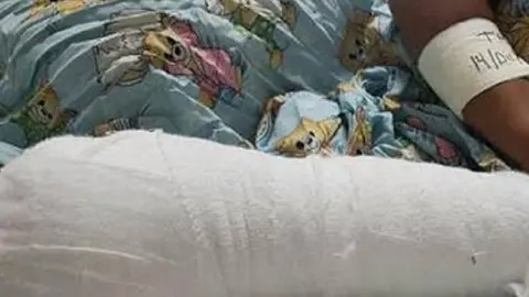 Menor casi pierde una mano tras ser apu&ntilde;alado