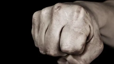 Rompen la nariz a un hombre en Marbella para robarle