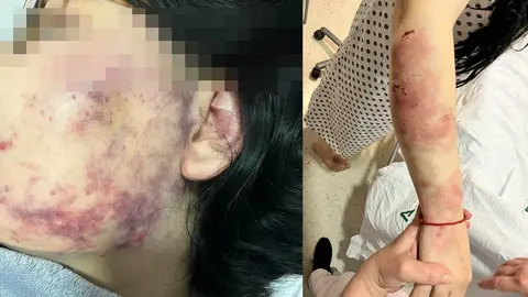 Paliza de muerte en Jerez a una menor