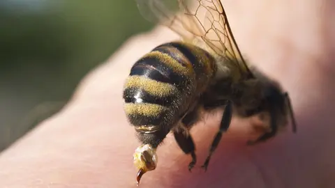 La picadura de una abeja deja a un hombre inconsciente en plena calle en Almer&iacute;a
