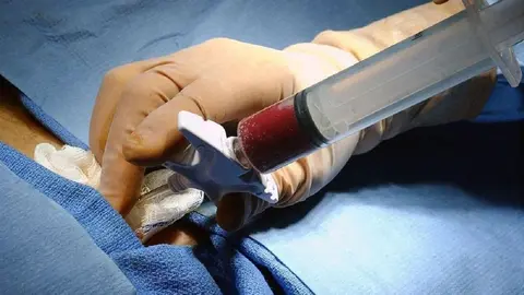 Andaluc&iacute;a bate un nuevo r&eacute;cord de trasplantes de m&eacute;dula