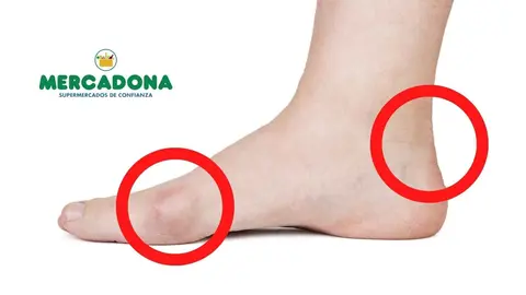 Las chanclas y sandalias hacen da&ntilde;o: la soluci&oacute;n de Mercadona para evitar las rozaduras