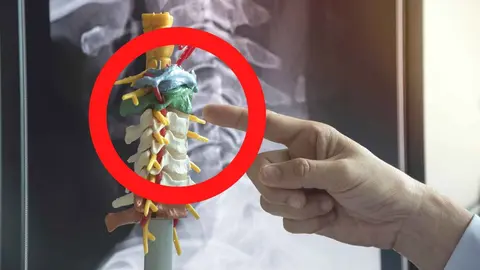 Lidl ficha el invento para asuntos cervicales