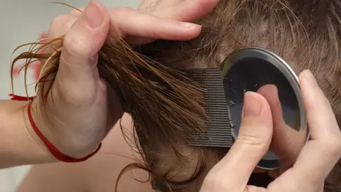 Adi&oacute;s piojos en ni&ntilde;os gracias a Mercadona