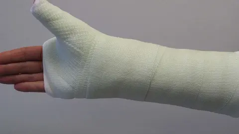 Acaba con la mano destrozada en un pub de Almer&iacute;a. Esta es la explicaci&oacute;n de la agresi&oacute;n