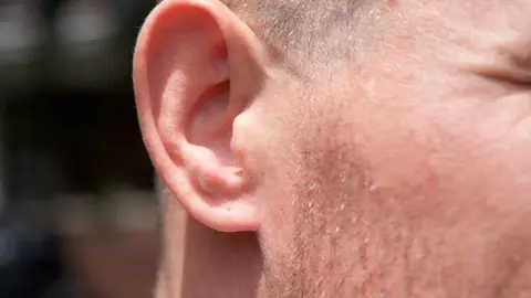 Arranca la oreja a un hombre durante una pelea en C&aacute;diz. Este es el relato de los hechos