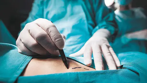 Un paciente fallece de un tromboembolismo despu&eacute;s de una cirug&iacute;a en Granada