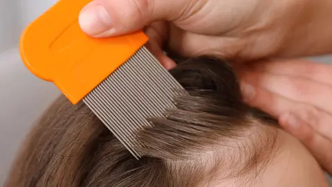 Loci&oacute;n infantil para liendres y piojos Deliplus de Mercadona