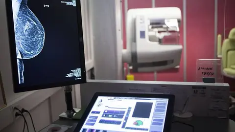 Estos son los avances para mejorar en el diagn&oacute;stico del c&aacute;ncer de mama en Andaluc&iacute;a