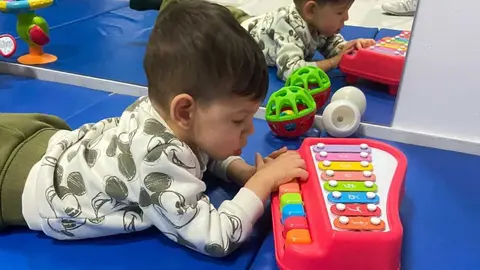 Mart&iacute;n, un peque&ntilde;o de 16 meses que padece el s&iacute;ndrome de Pettigrew