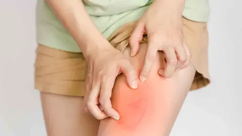 Crema antirozaduras APTONIA de Decathlon