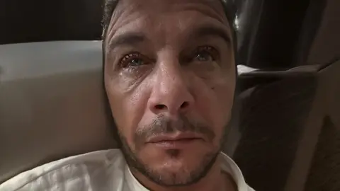 Joaqu&iacute;n S&aacute;nchez con conjuntivitis