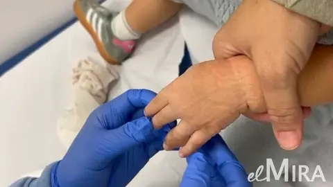 Quemadura de ni&ntilde;o en Jerez de la Frontera 