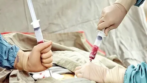 Ja&eacute;n contabilza un gran n&uacute;mero de donantes de m&eacute;dula &oacute;sea