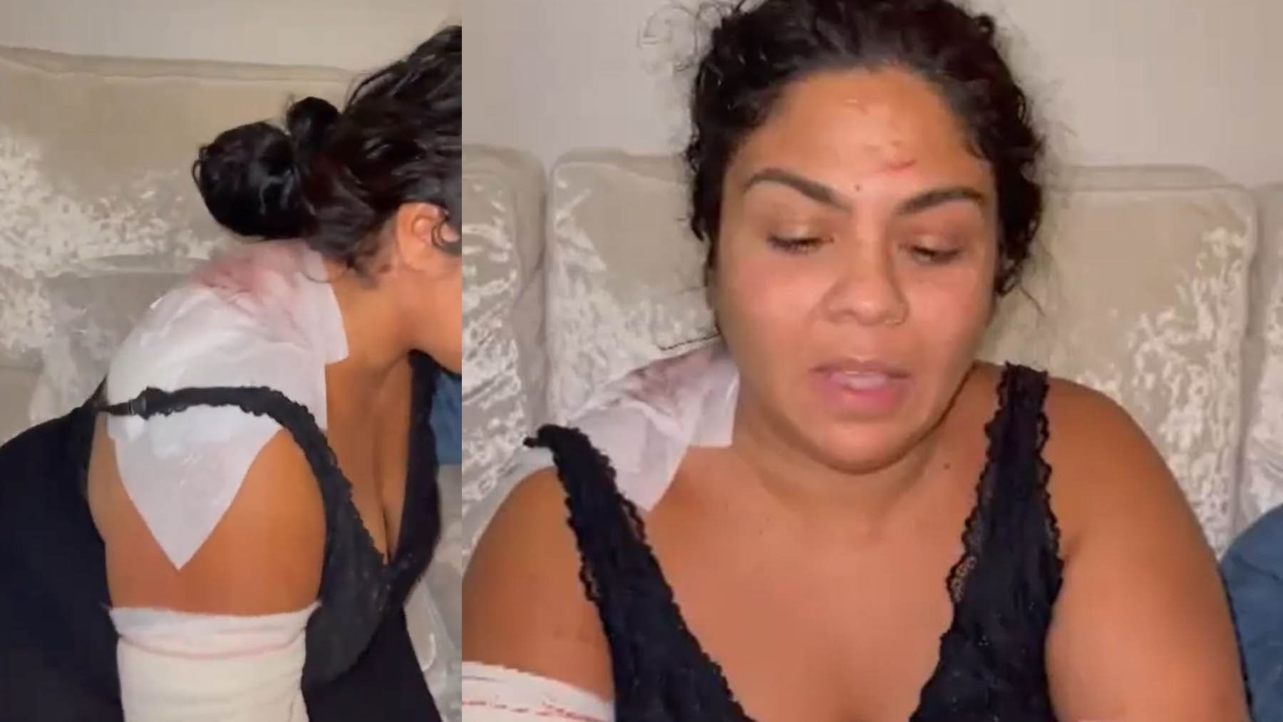 Saray Montoya en su domicilio muestra las heridas de ella y su madre