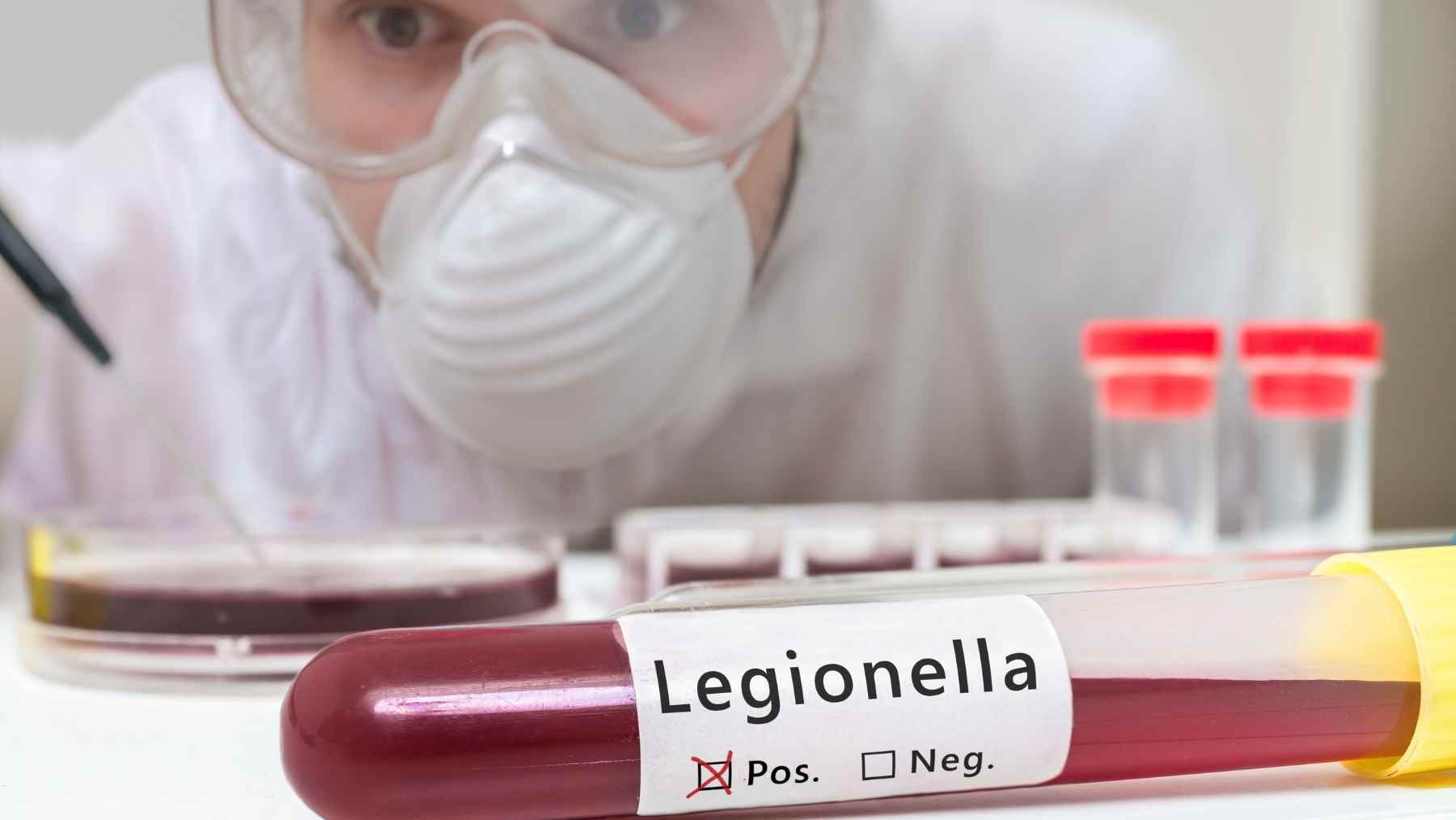 Legionella