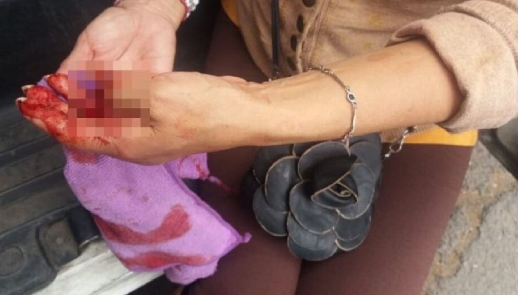 Una mujer se ha comido dos dedos en Sevilla