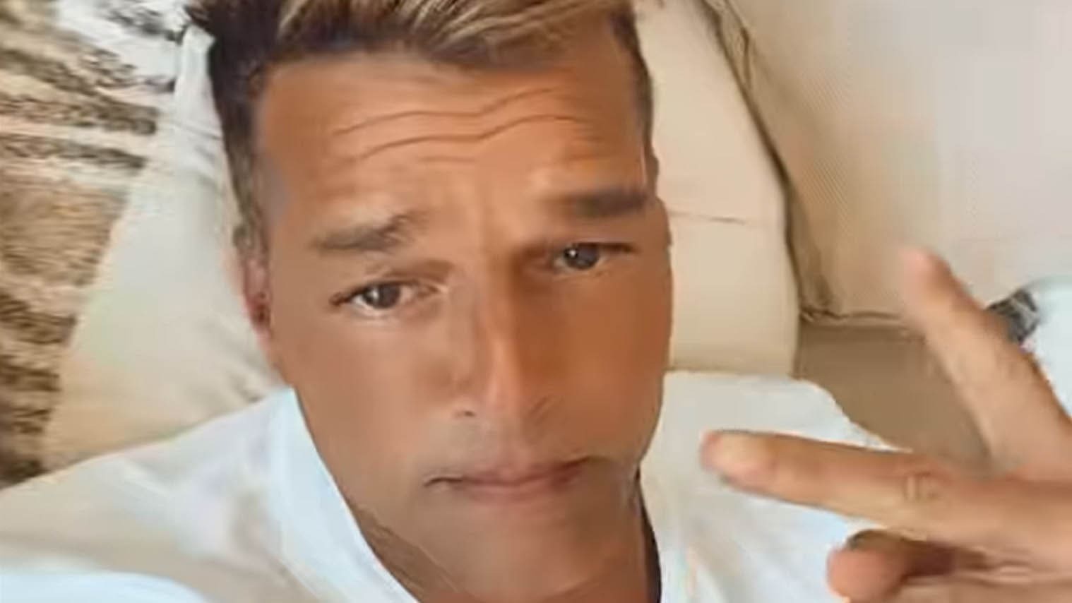 Ricky Martín y los retoques estéticos en su cara que escandalizan a sus fans