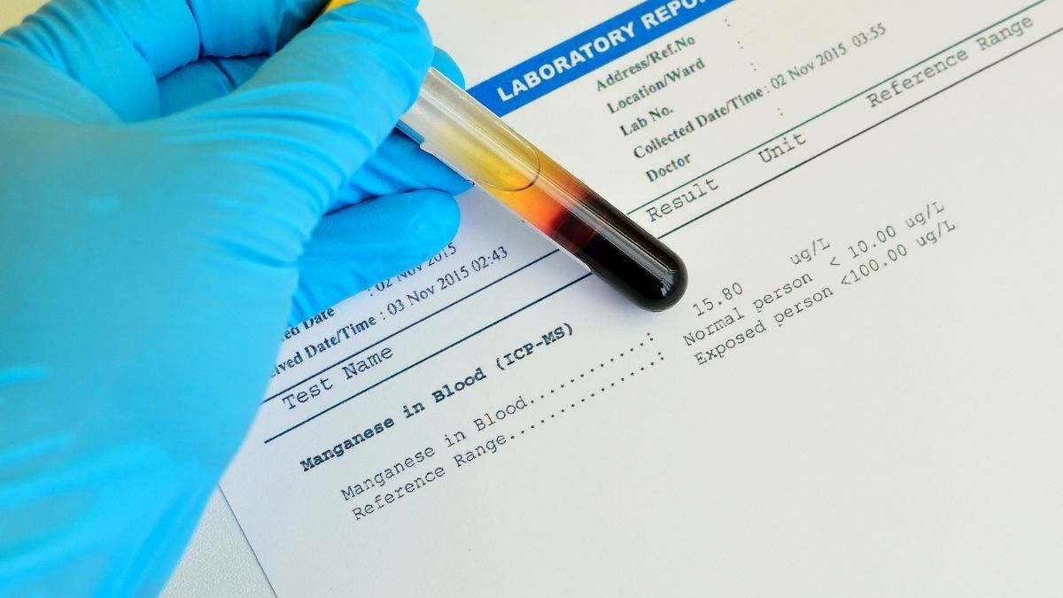 MANGANESO EN SANGRE