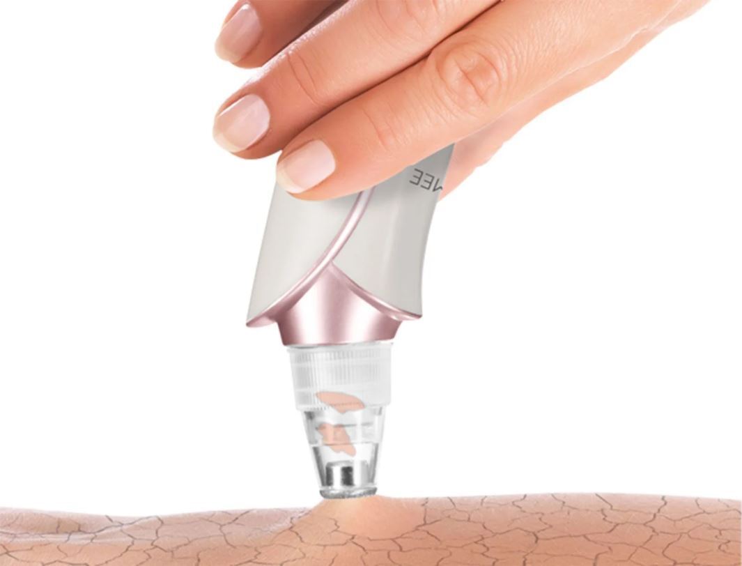 limpiador de poros lidl maxxmee