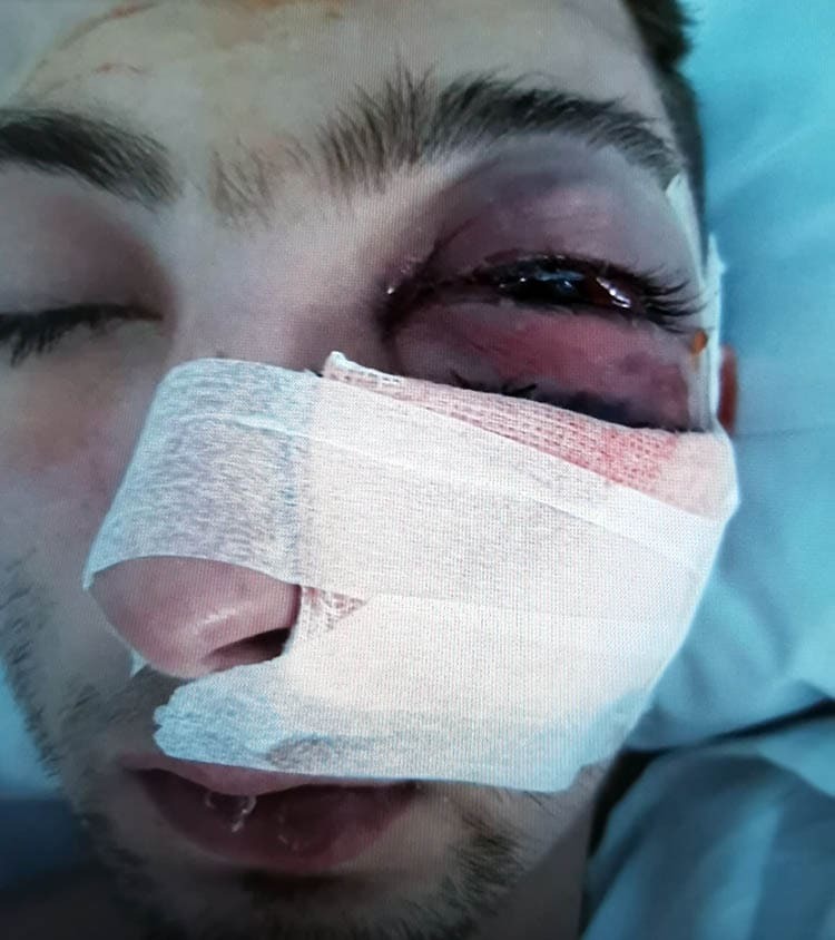 La agresión en Jerez del joven Andrés con discapacidad intelectual es un caso de discafobia 3