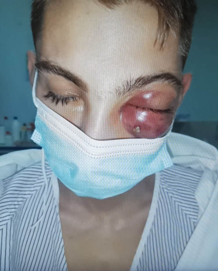 La agresión en Jerez del joven Andrés con discapacidad intelectual es un caso de discafobia 1