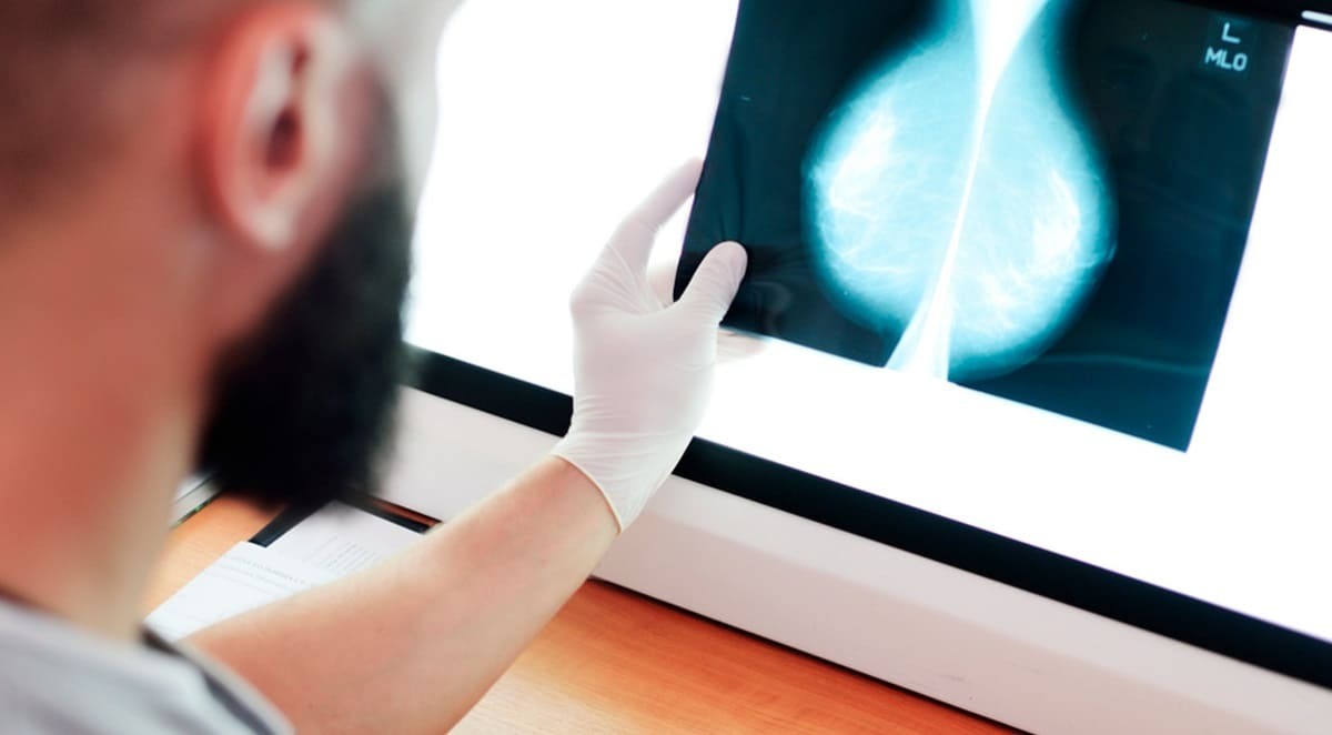 Andalucía amplía el cribado de cáncer de mama a 5 nuevos grupos de edad 47, 48, 49, 70 y 71 años