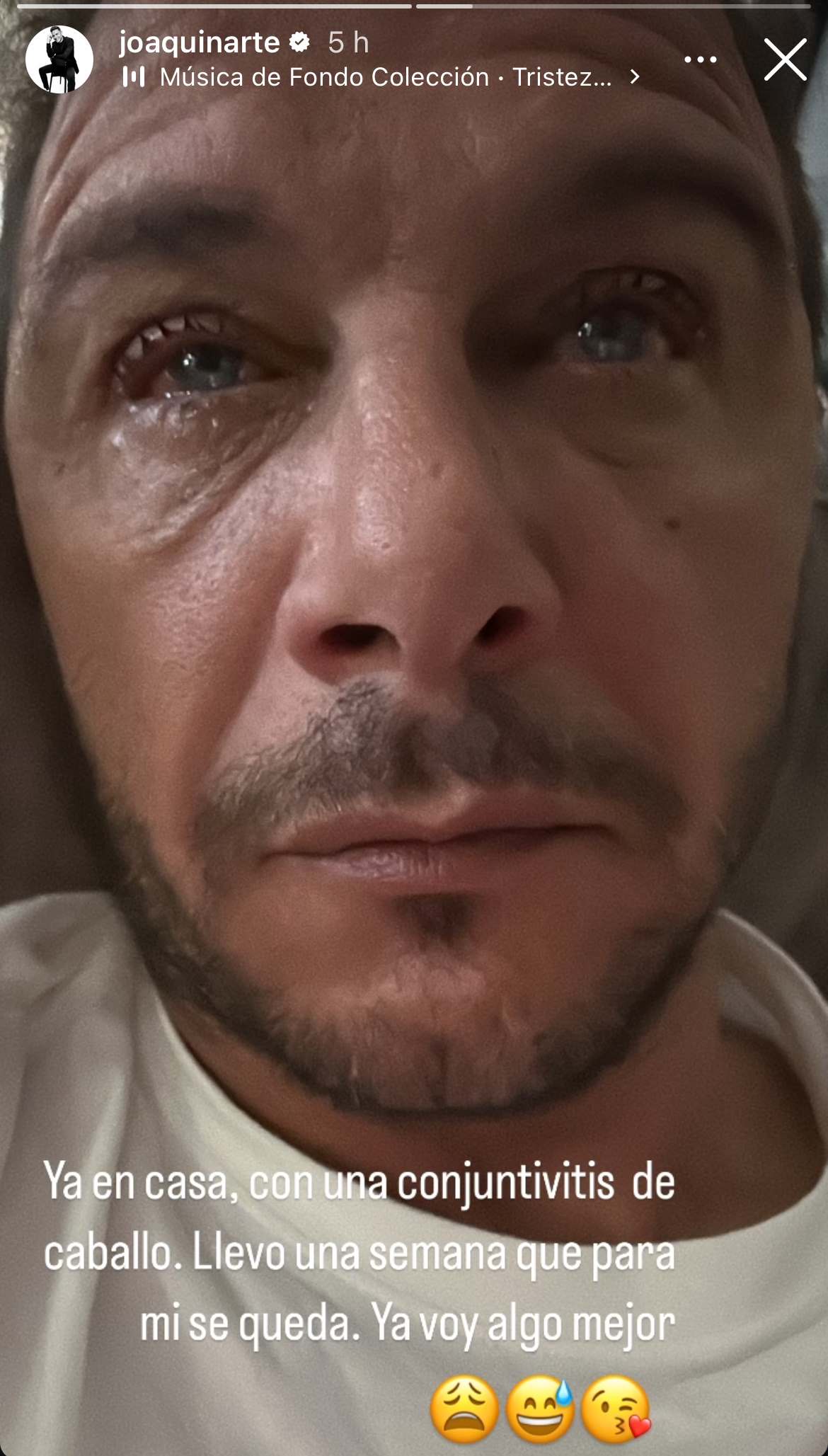 Joaquín Sánchez con conjuntivitis | Instagram