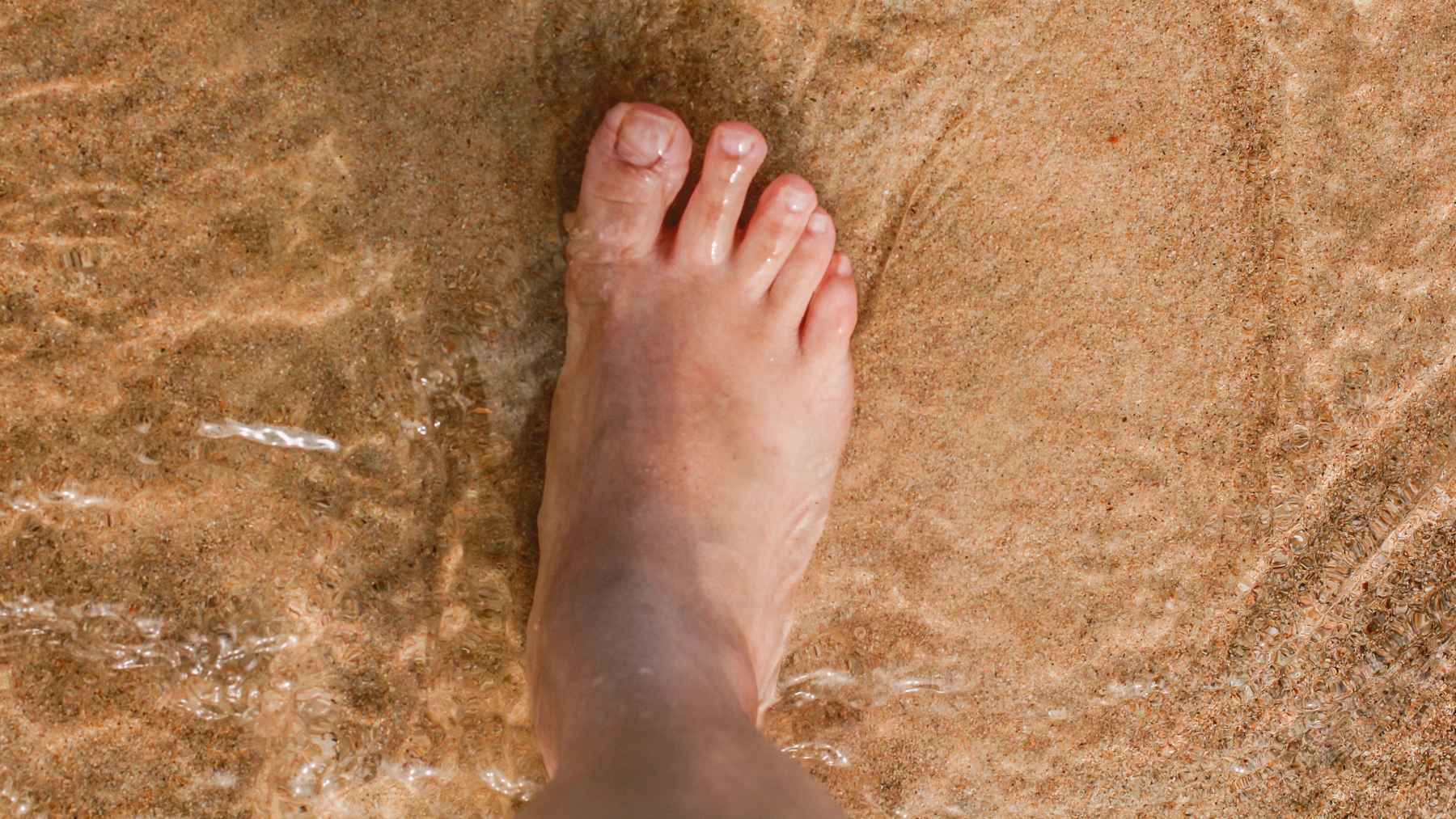 Picadura de pez araña o faneca