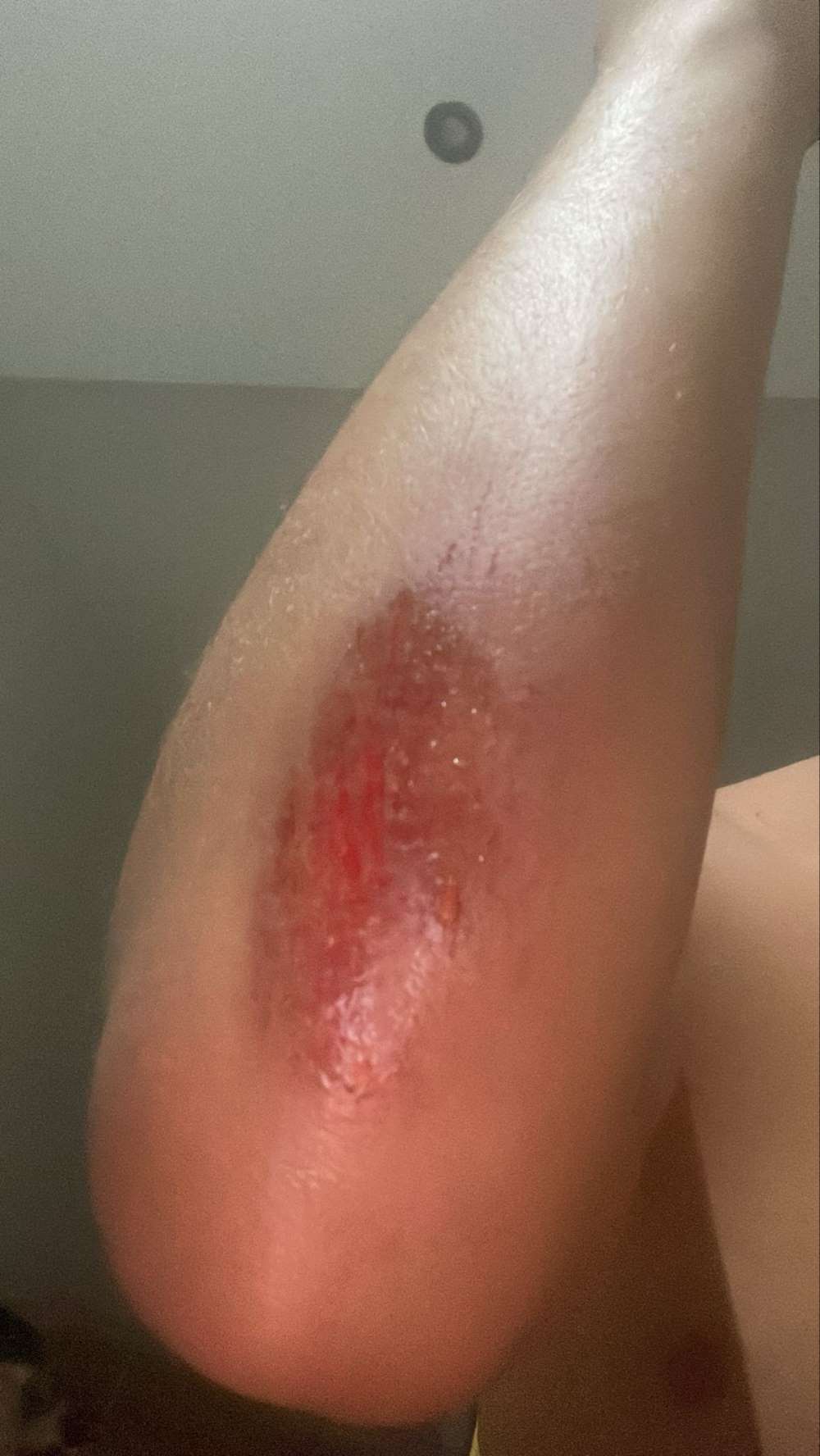 Lesiones en el campo de fútbol anexo del Pedro S. Garrido