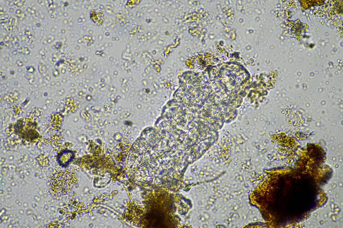 Tardígrado en una muestra bajo el microscopio