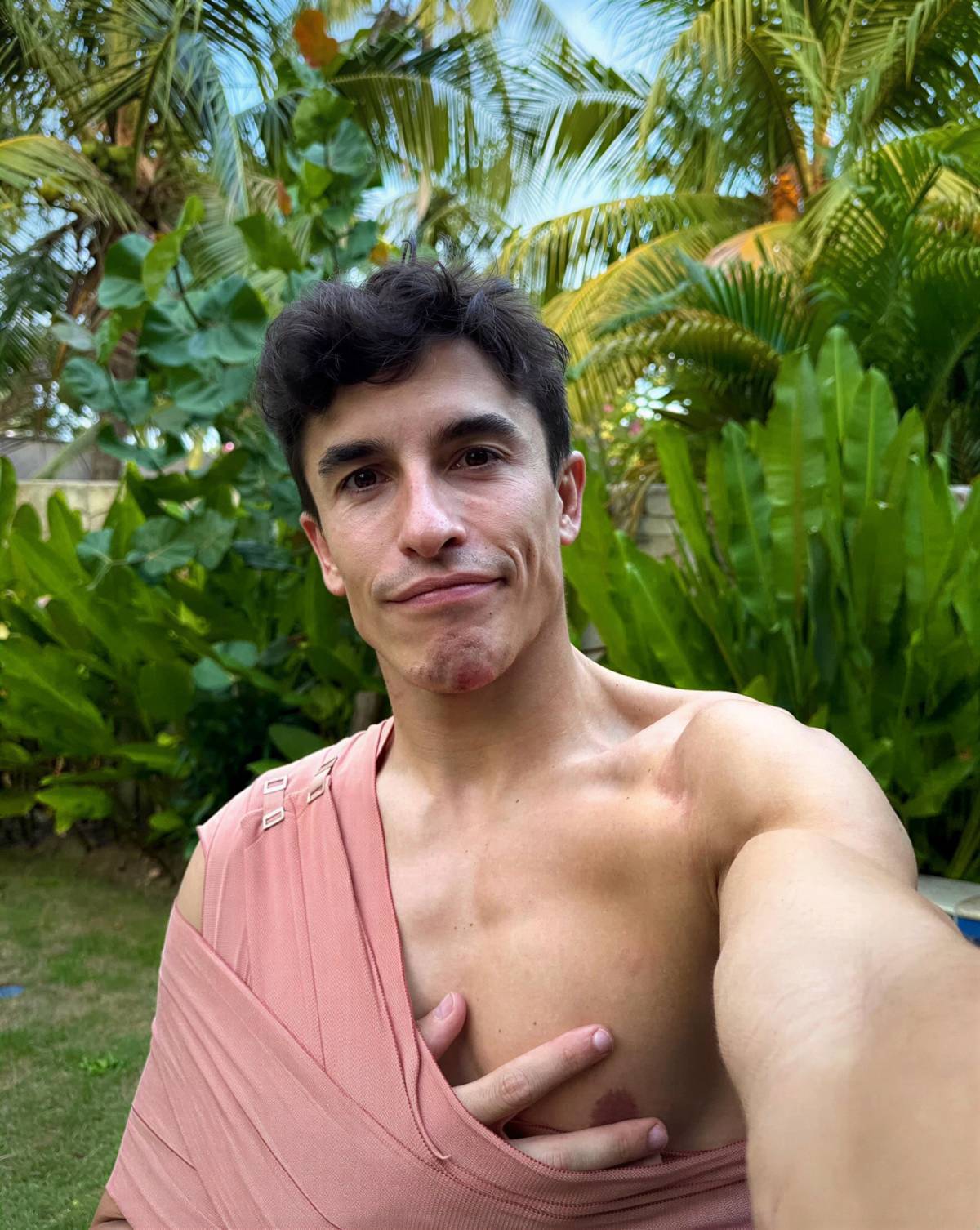 Marc Márquez tras su lesión