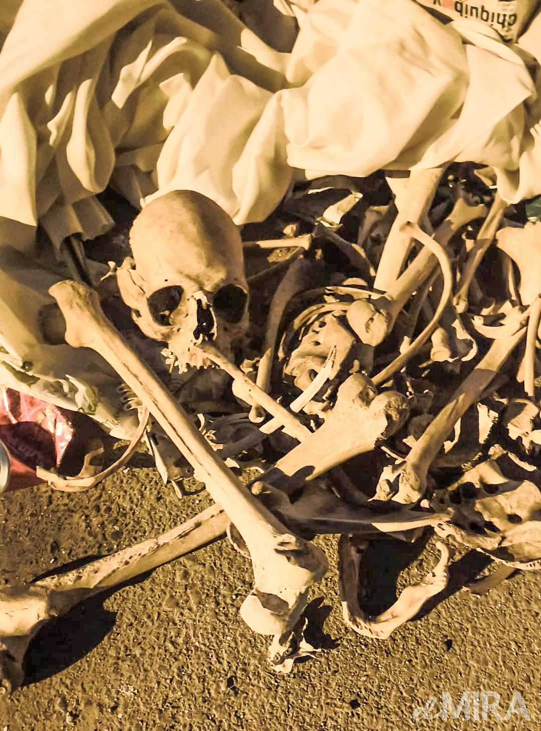 La Policía Nacional investiga el origen de dos esqueletos hallados en contenedores distintos y no descarta un depósito deliberado en zonas alejadas del tránsito habitual