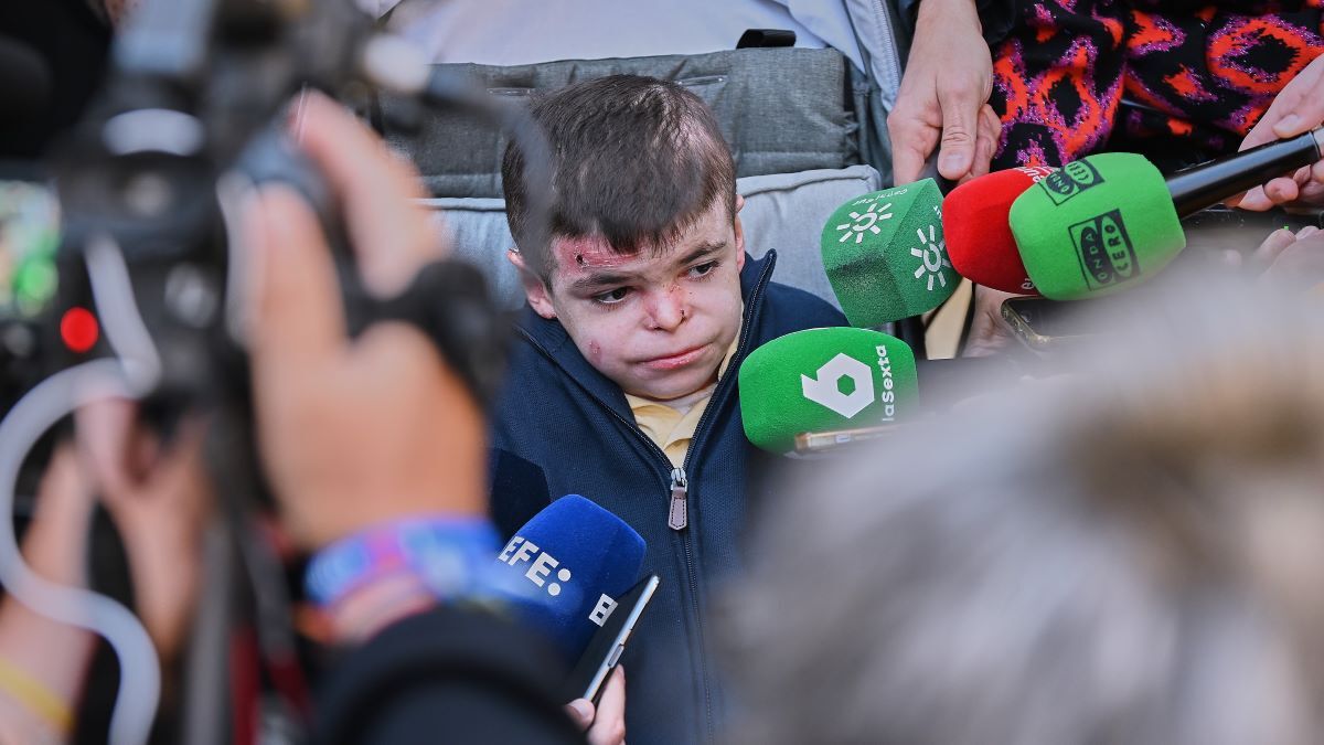 Leo, uno de los afectados con Piel de Mariposa en Andalucía | Salvador López Medina