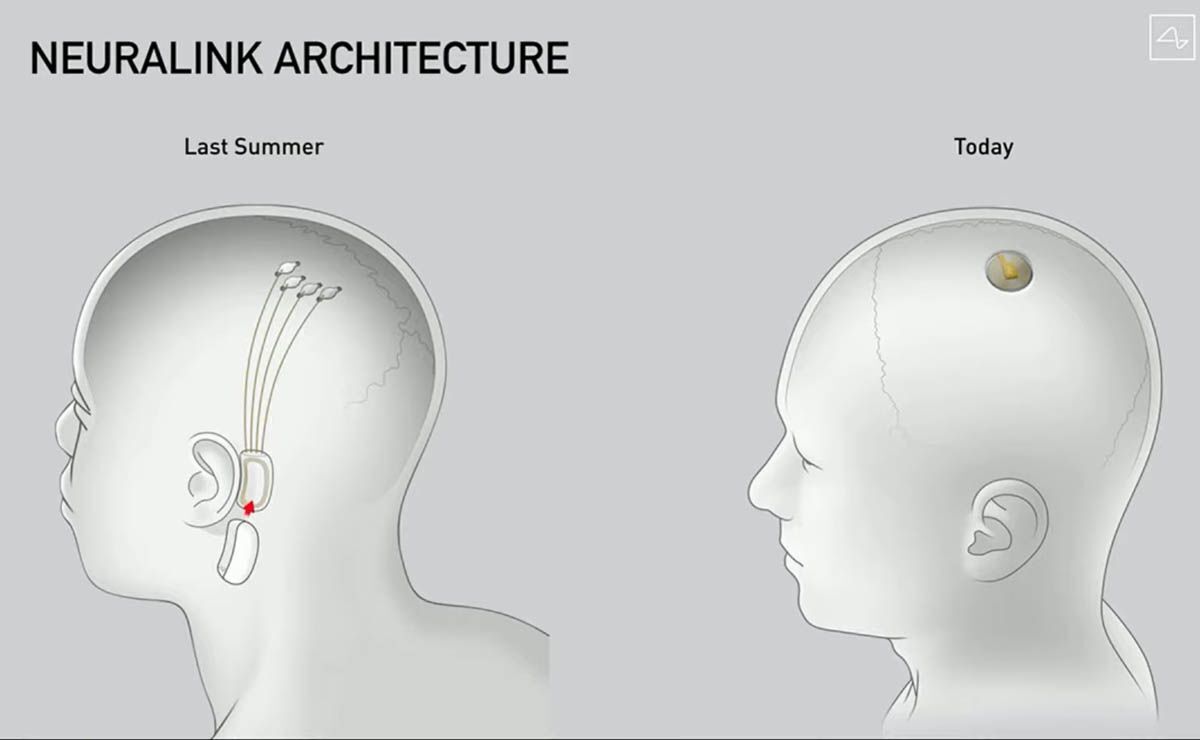 El Neuralink de Elon Musk pretende leer tu cerebro