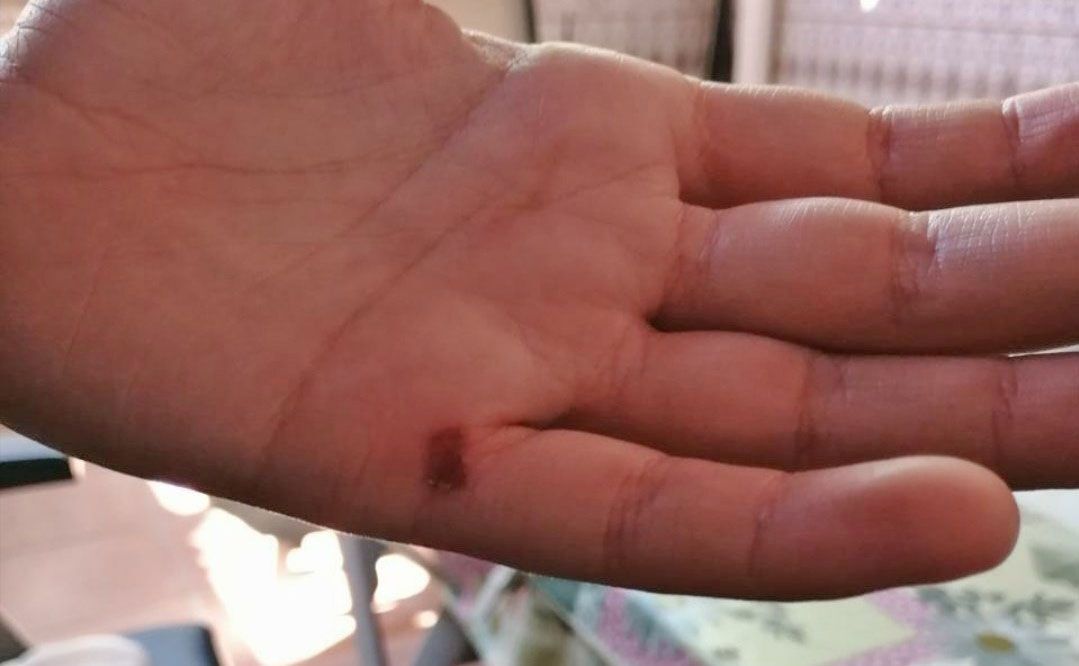 Jerez Intentan violar a una mujer persiguiéndola en moto con el pene por fuera agresión