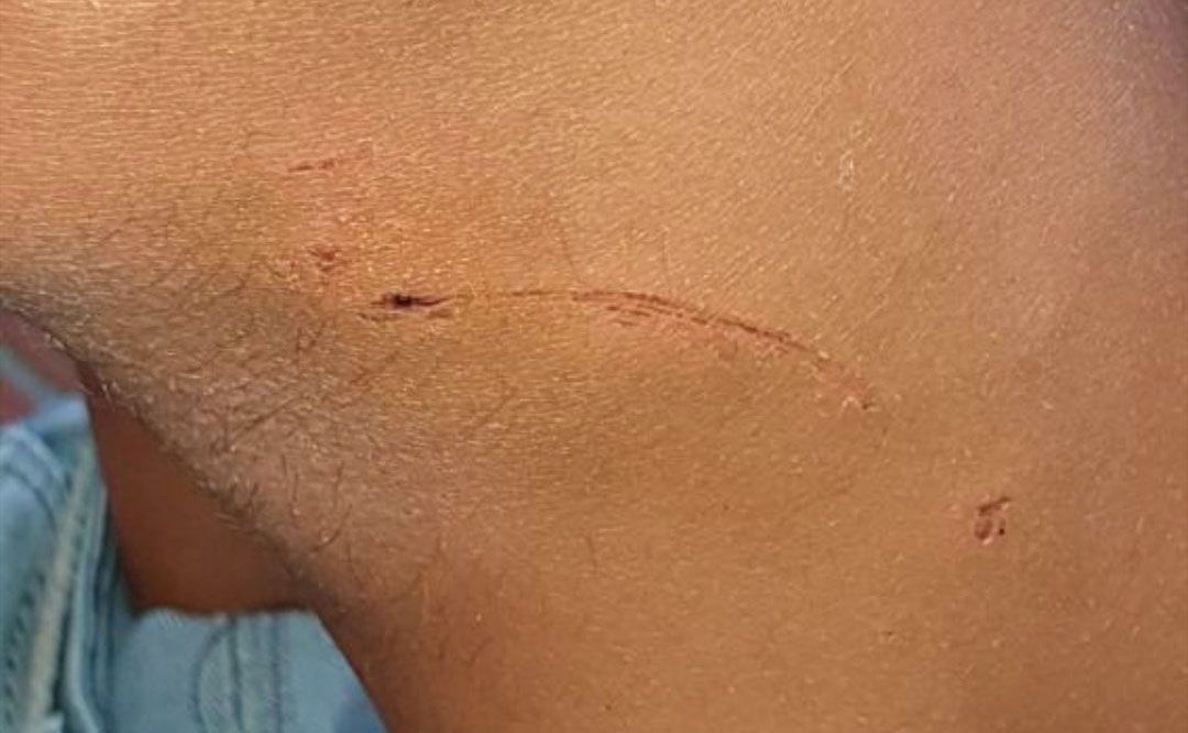 Jerez Intentan violar a una mujer persiguiéndola en moto con el pene por fuera agresión