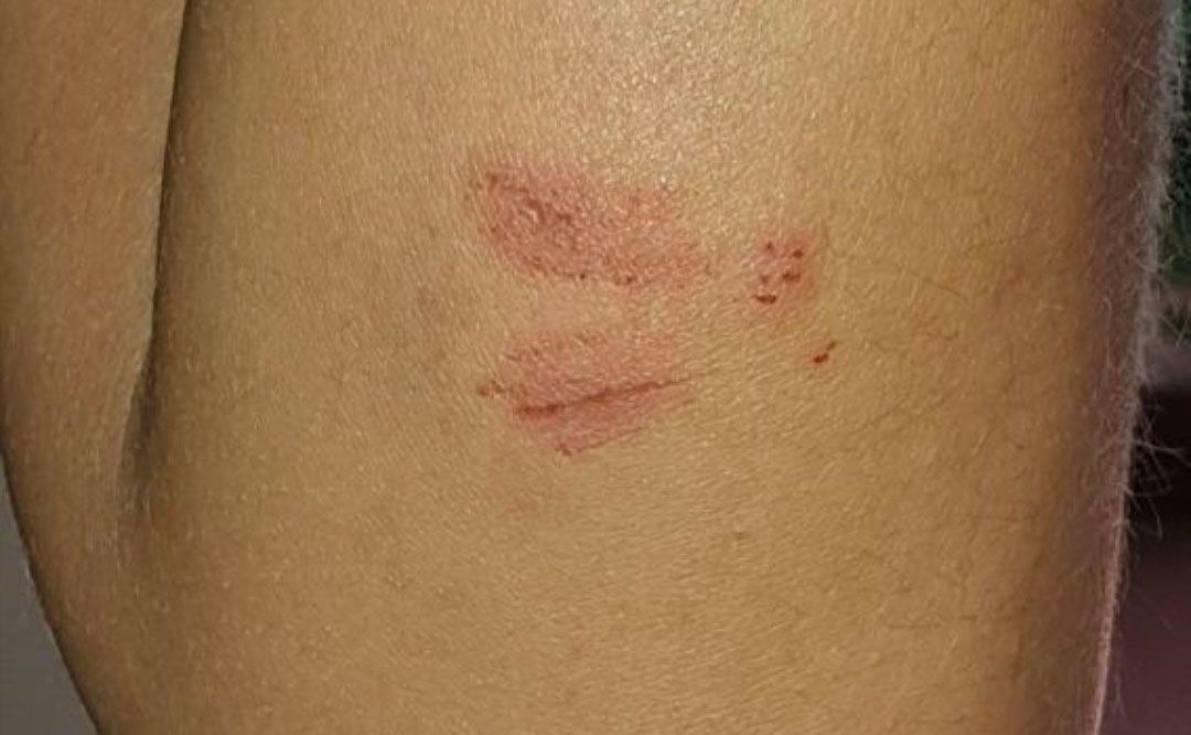 Jerez Intentan violar a una mujer persiguiéndola en moto con el pene por fuera agresión