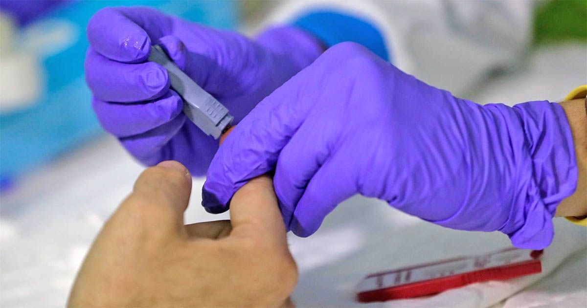 reinfección por Covid-19